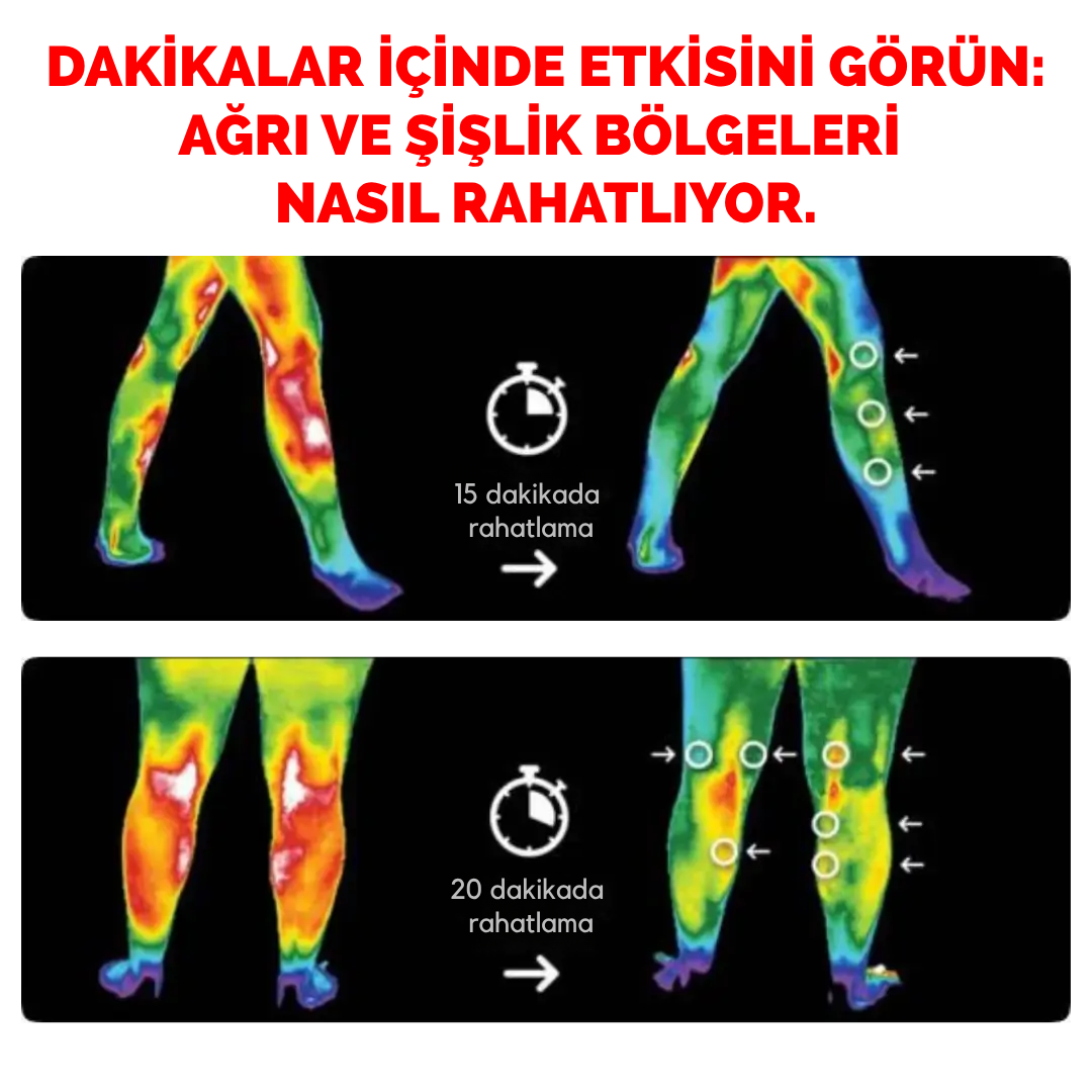 Bionera 2.0 Diz Masaj Aleti